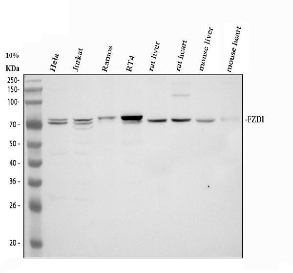 Western blot analysis of FZD1 using anti-FZD1 antibody (PB9594)