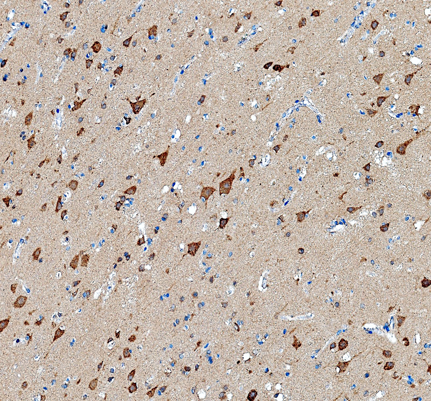 pb9599 htr2a primary antibodies ihc testing 1