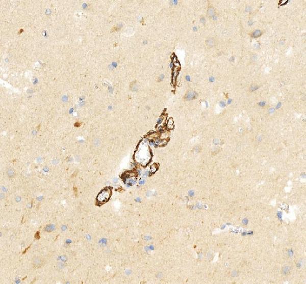 IHC analysis of HTR2A using anti-HTR2A antibody (PB9599)