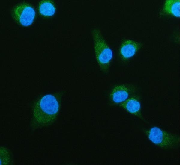 pb9602 idh2 primary antibodies if testing 6