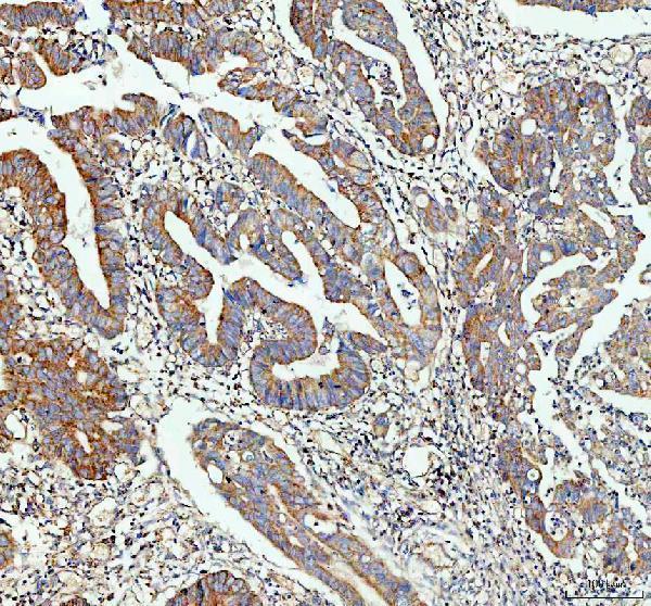  IHC analysis of IDH2 using anti-IDH2 antibody (PB9602)