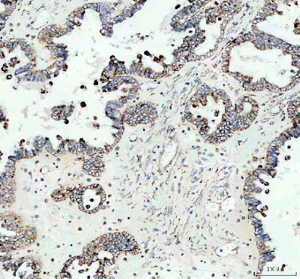  IHC analysis of IDH2 using anti-IDH2 antibody (PB9602)