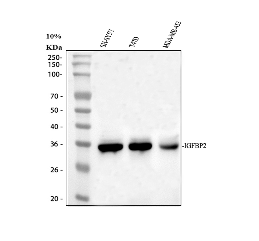 Western blot analysis of IGFBP2 using anti-IGFBP2 antibody (PB9605)
