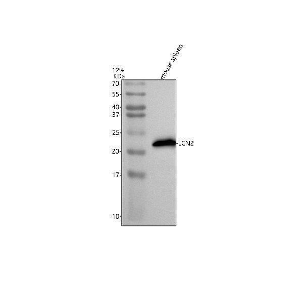  Western blot analysis of Lipocalin-2/NGAL/LCN2 using anti-Lipocalin-2/NGAL/LCN2 antibody (PB9608)