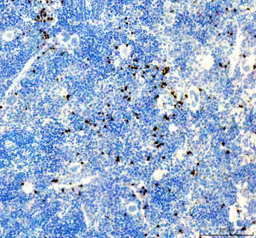 pb9609 lcn2 primary antibodies ihc testing 1