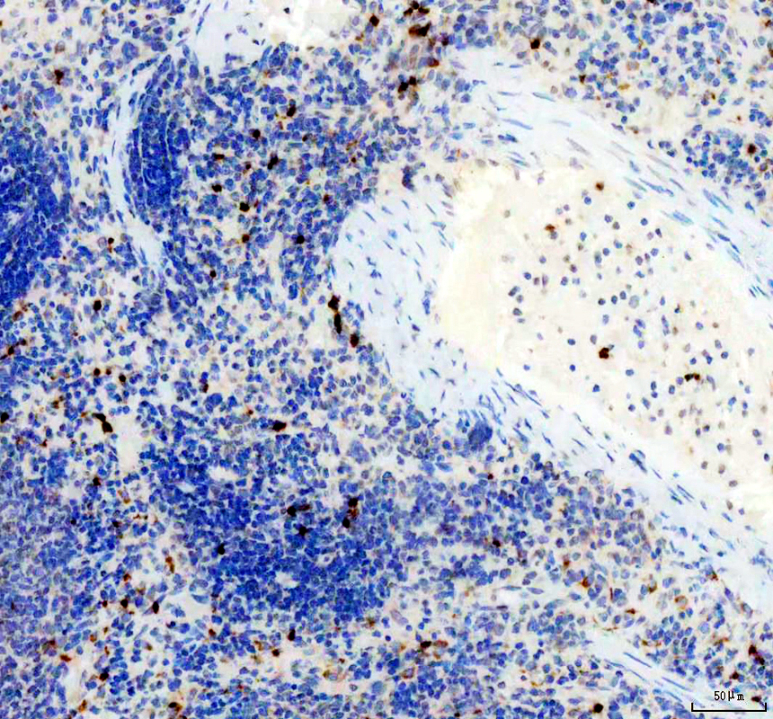 pb9609 lcn2 primary antibodies ihc testing 3
