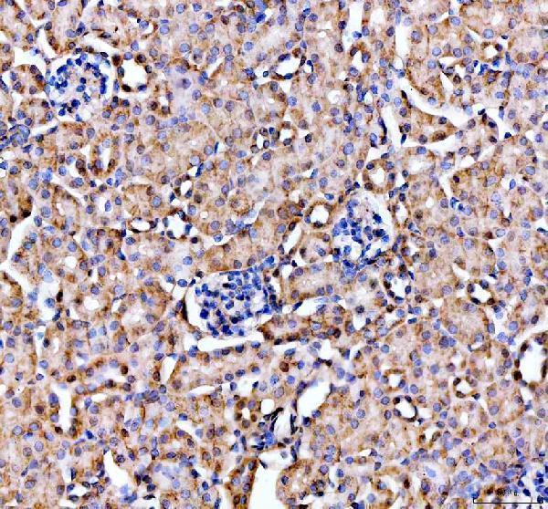 pb9609 lipocalin_2 primary antibodies ihc testing 7_1