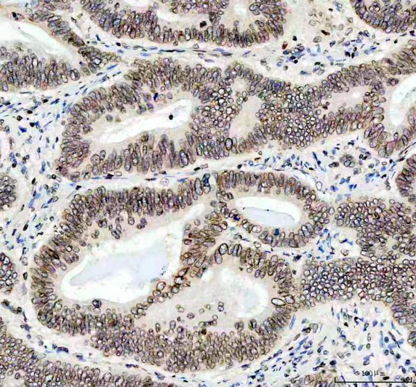 pb9611 lmnb1 primary antibodies ihc testing 2_1