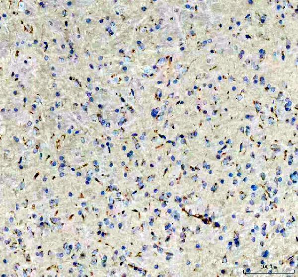 pb9616 otof primary antibodies ihc testing 2