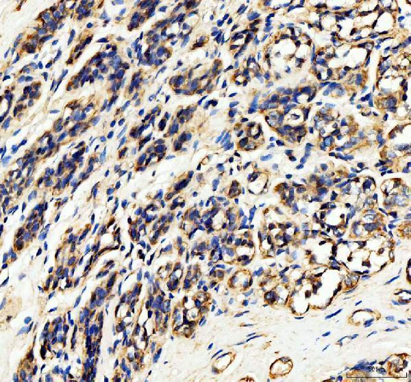 IHC analysis of HDAC6 using anti-HDAC6 antibody (PB9628)