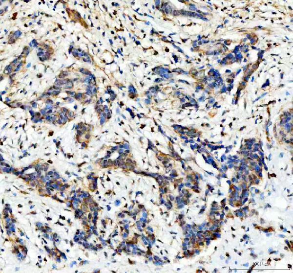 IHC analysis of HDAC6 using anti-HDAC6 antibody (PB9628)