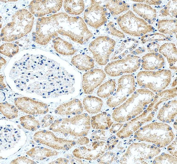 pb9630 hdac11 primary antibodies ihc testing 4