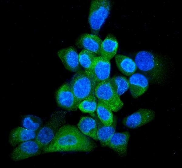 Figure 6. IF analysis of GRP94 using anti-GRP94 antibody (PB9637). GRP94 was detected in immunocytochemical section of A431 cells. Enzyme antigen retrieval was performed using IHC enzyme antigen retrieval reagent (AR0022) for 15 mins. The cells were blocked with 10% goat serum. And then incubated with 5 microg/mL rabbit anti-GRP94 Antibody (PB9637) overnight at 4°C. DyLight®488 Conjugated Goat Anti-Rabbit IgG (BA1127) was used as secondary antibody at 1:100 dilution and incubated for 30 minutes at 37°C. The section was counterstained with DAPI. Visualize using a fluorescence microscope and filter sets appropriate for the label used.