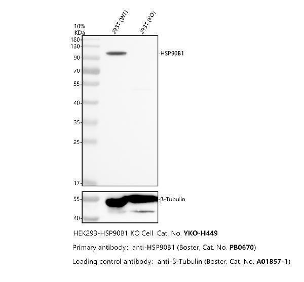 Western blot analysis of GRP94/HSP90B1 using anti-GRP94/HSP90B1 antibody (PB9637)