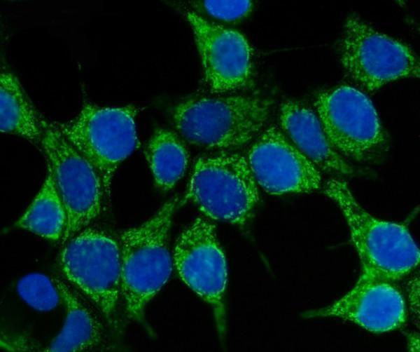pb9638 hsp70 primary antibodies if testing 5_1