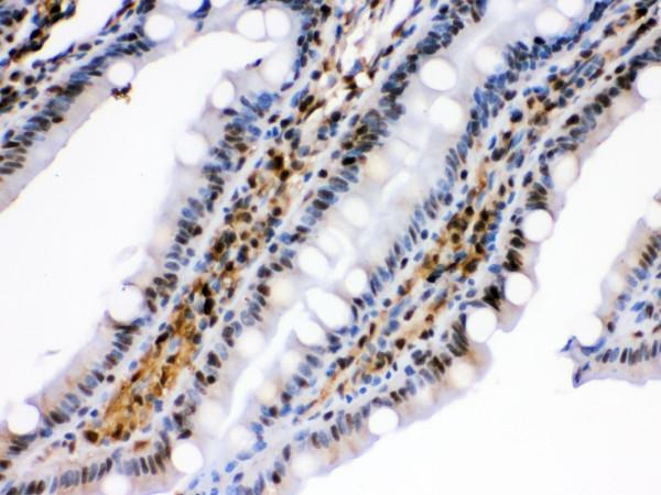 pb9639 3 ihc anti hspa2 picoband antibody