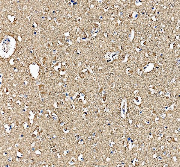 pb9640 hspa5 primary antibodies ihc testing 1