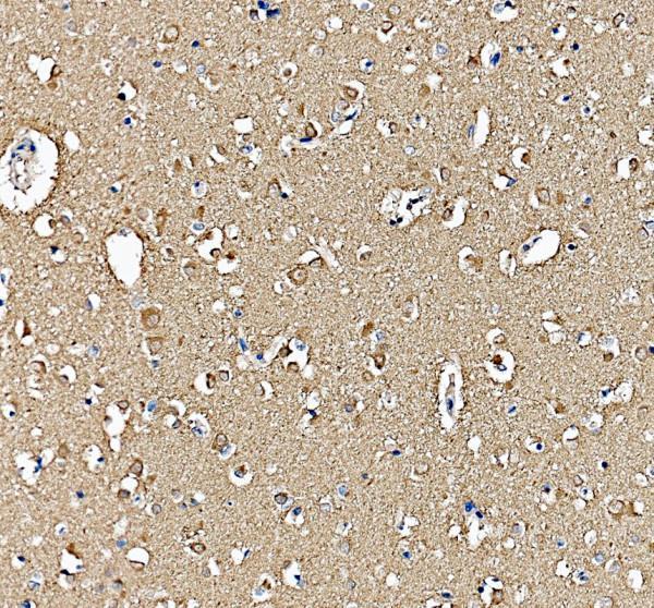 pb9640 hspa5 primary antibodies ihc testing 1_1
