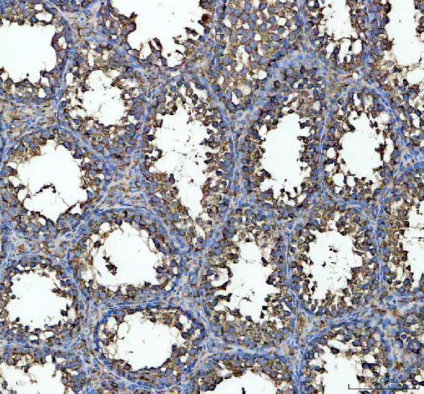 pb9640 hspa5 primary antibodies ihc testing 2