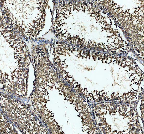 pb9640 hspa5 primary antibodies ihc testing 3