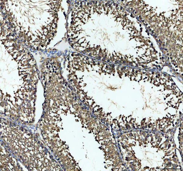 pb9640 hspa5 primary antibodies ihc testing 3_1