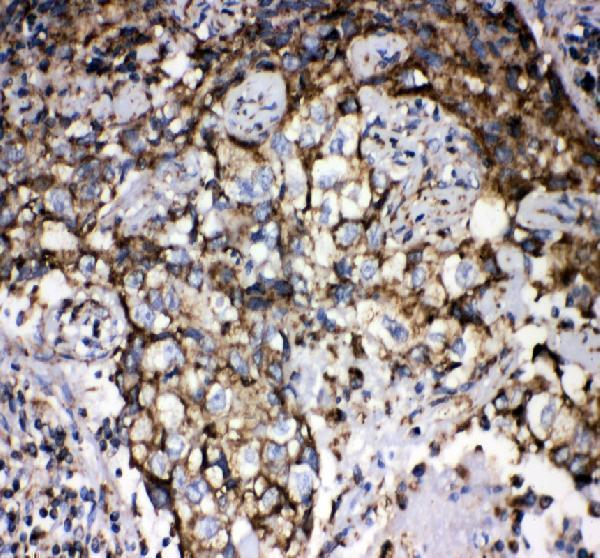 pb9642 grp75 primary antibodies ihc testing 2