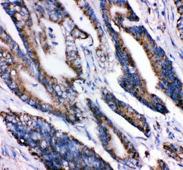 pb9642 grp75 primary antibodies ihc testing 3