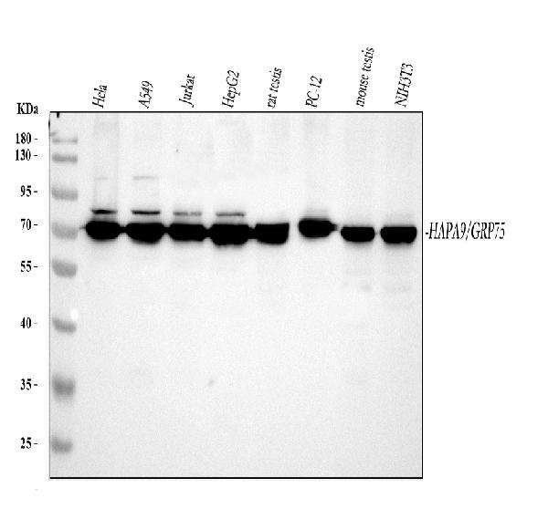 Figure 1. Western blot analysis of Grp75 using anti-Grp75 antibody (PB9642). Electrophoresis was performed on a 5-20% SDS-PAGE gel at 70V (Stacking gel) / 90V (Resolving gel) for 2-3 hours. The sample well of each lane was loaded with 30 ug of sample under reducing conditions. Lane 1: human Hela whole cell lysates, Lane 2: human A549 whole cell lysates, Lane 3: human Jurkat whole cell lysates, Lane 4: human HepG2 whole cell lysates, Lane 5: rat testis tissue lysates, Lane 6: rat PC-12 whole cell lysates, Lane 7: mouse testis tissue lysates, Lane 8: mouse NIH/3T3 whole cell lysates. After electrophoresis, proteins were transferred to a nitrocellulose membrane at 150 mA for 50-90 minutes. Blocked the membrane with 5% non-fat milk/TBS for 1.5 hour at RT. The membrane was incubated with rabbit anti-Grp75 antigen affinity purified polyclonal antibody (Catalog # PB9642) at 0.5 microg/mL overnight at 4°C, then washed with TBS-0.1%Tween 3 times with 5 minutes each and probed with a goat anti-rabbit IgG-HRP secondary antibody at a dilution of 1:5000 for 1.5 hour at RT. The signal is developed using an Enhanced Chemiluminescent detection (ECL) kit (Catalog # EK1002) with Tanon 5200 system. A specific band was detected for Grp75 at approximately 74 kDa. The expected band size for Grp75 is at 74 kDa. Figure 1. Western blot analysis of Grp75 using anti-Grp75 antibody (PB9642). Electrophoresis was performed on a 5-20% SDS-PAGE gel at 70V (Stacking gel) / 90V (Resolving gel) for 2-3 hours. The sample well of each lane was loaded with 30 ug of sample under reducing conditions. Lane 1: human Hela whole cell lysates, Lane 2: human A549 whole cell lysates, Lane 3: human Jurkat whole cell lysates, Lane 4: human HepG2 whole cell lysates, Lane 5: rat testis tissue lysates, Lane 6: rat PC-12 whole cell lysates, Lane 7: mouse testis tissue lysates, Lane 8: mouse NIH/3T3 whole cell lysates. After electrophoresis, proteins were transferred to a nitrocellulose membrane at 150 mA for 50-90 minutes. Blocked the membrane with 5% non-fat milk/TBS for 1.5 hour at RT. The membrane was incubated with rabbit anti-Grp75 antigen affinity purified polyclonal antibody (Catalog # PB9642) at 0.5 microg/mL overnight at 4°C, then washed with TBS-0.1%Tween 3 times with 5 minutes each and probed with a goat anti-rabbit IgG-HRP secondary antibody at a dilution of 1:5000 for 1.5 hour at RT. The signal is developed using an Enhanced Chemiluminescent detection (ECL) kit (Catalog # EK1002) with Tanon 5200 system. A specific band was detected for Grp75 at approximately 74 kDa. The expected band size for Grp75 is at 74 kDa.