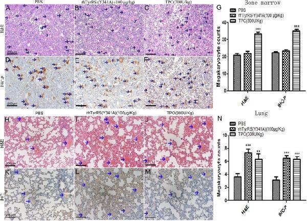 The effects of rhTyrRS(Y341A) on megakaryocytes were studied by immunohistochemistry and ( H & E ) staining in the bone marrow and lung