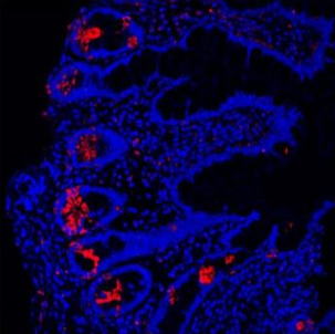 pb9663 lysozyme primary antibodies if testing 3