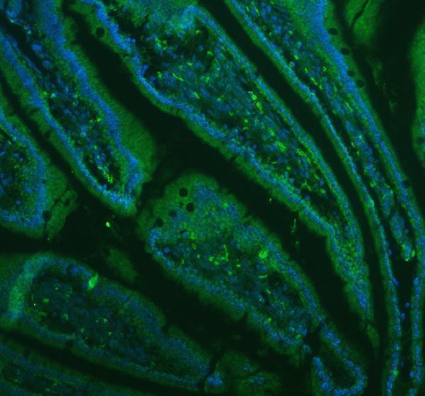 pb9663 lyz primary antibodies if testing 7