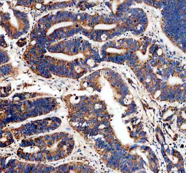 pb9665 maob primary antibodies ihc testing 1