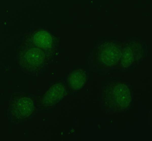 IF analysis of NDRG2 using anti-NDRG2 antibody (PB9672)