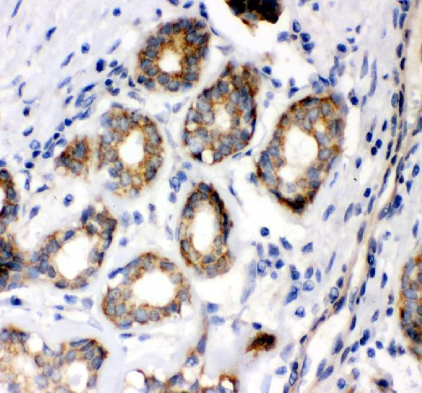 pb9674 ptk2 primary antibodies ihc testing 1