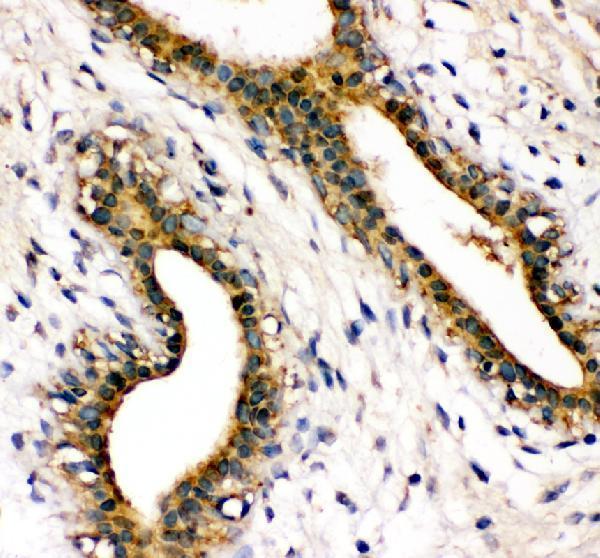 IHC analysis of SHP2/PTPN11 using anti-SHP2/PTPN11 antibody (PB9675)