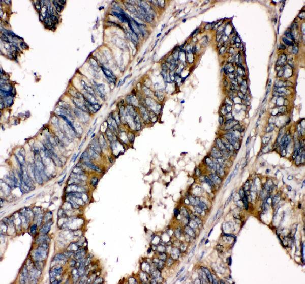 IHC analysis of SHP2/PTPN11 using anti-SHP2/PTPN11 antibody (PB9675)