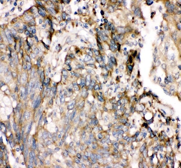 pb9675 ptpn11 primary antibodies ihc testing 3