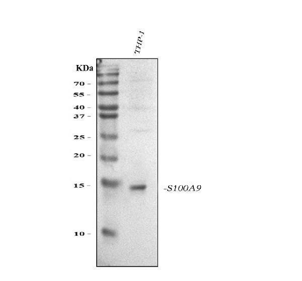 pb9677 s100a9 primary antibodies wb testing 1
