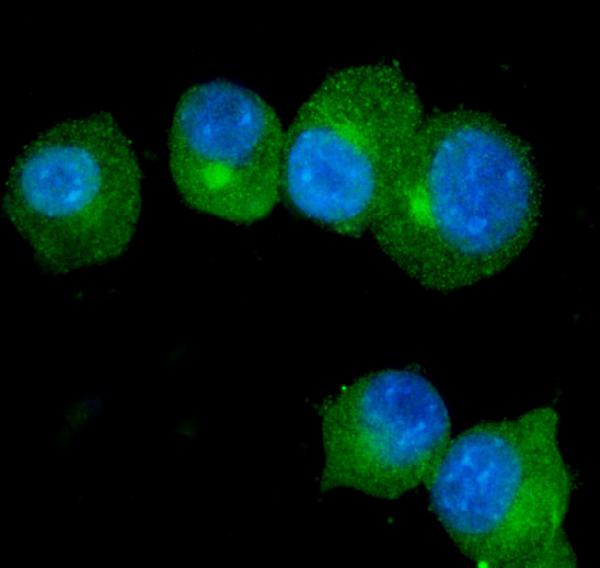 Figure 4. IF analysis of S100A9 using anti-S100A9 antibody (PB9678). S100A9 was detected in immunocytochemical section of HEPA1-6 cells. Enzyme antigen retrieval was performed using IHC enzyme antigen retrieval reagent (AR0022) for 15 mins. The cells were blocked with 10% goat serum. And then incubated with 5microg/mL rabbit anti-S100A9 Antibody (PB9678) overnight at 4°C. DyLight®488 Conjugated Goat Anti-Rabbit IgG (BA1127) was used as secondary antibody at 1:100 dilution and incubated for 30 minutes at 37°C. The section was counterstained with DAPI. Visualize using a fluorescence microscope and filter sets appropriate for the label used. Figure 4. IF analysis of S100A9 using anti-S100A9 antibody (PB9678). S100A9 was detected in immunocytochemical section of HEPA1-6 cells. Enzyme antigen retrieval was performed using IHC enzyme antigen retrieval reagent (AR0022) for 15 mins. The cells were blocked with 10% goat serum. And then incubated with 5microg/mL rabbit anti-S100A9 Antibody (PB9678) overnight at 4°C. DyLight®488 Conjugated Goat Anti-Rabbit IgG (BA1127) was used as secondary antibody at 1:100 dilution and incubated for 30 minutes at 37°C. The section was counterstained with DAPI. Visualize using a fluorescence microscope and filter sets appropriate for the label used.