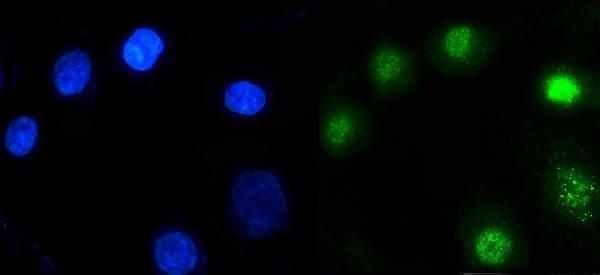 IF analysis of ARID1A using anti-ARID1A antibody (PB9685)