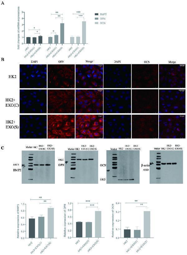 Effects of exosomes on the activation of osteoblastic-associated protein expression in HK2 cells