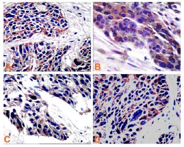 pb9687 13046_2010_article_332_fig3_html