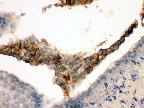  IHC analysis of GNAQ using anti-GNAQ antibody (PB9707)