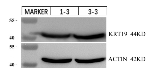 pb9715 cytokeratin 19 primary antibodies wb testing 1