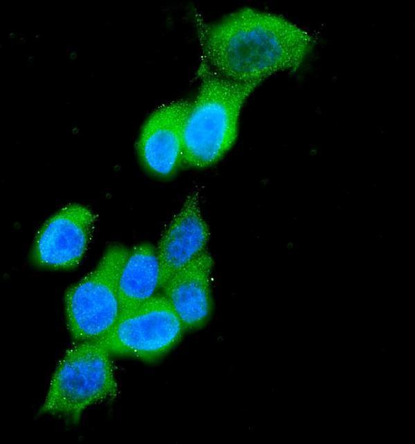 pb9715 krt19 primary antibodies if testing 14_1