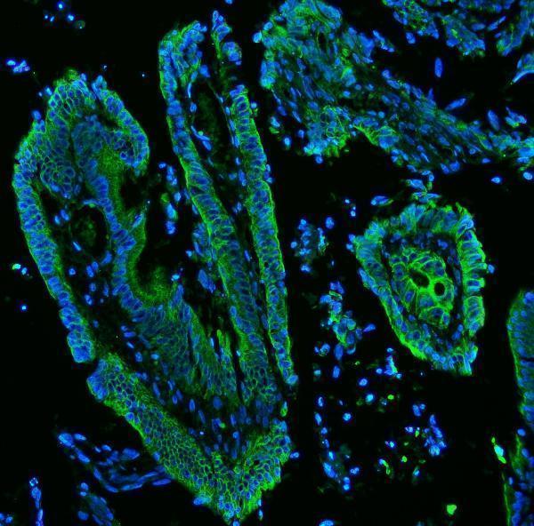 pb9715 krt19 primary antibodies if testing 15_1