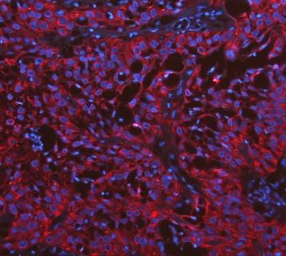 pb9715 krt19 primary antibodies if testing 16_1