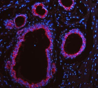 pb9715 krt19 primary antibodies if testing 17_1