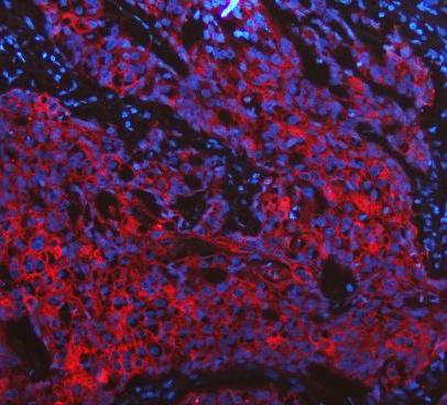 pb9715 krt19 primary antibodies if testing 18_1