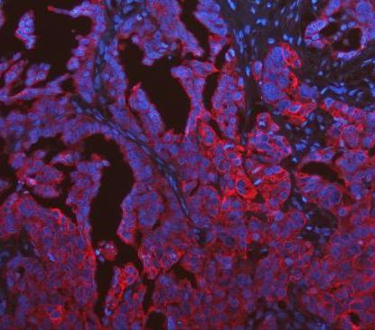 pb9715 krt19 primary antibodies if testing 19_1